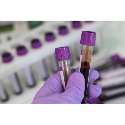 特殊物品进口报关